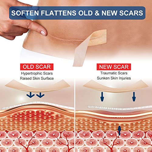 Silicone Scar Sheets Roll J530