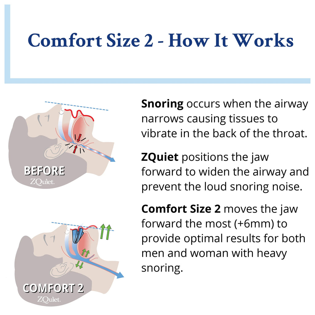 Comfort Size #2 Anti-Snoring Mouthpiece (Clear) S627422