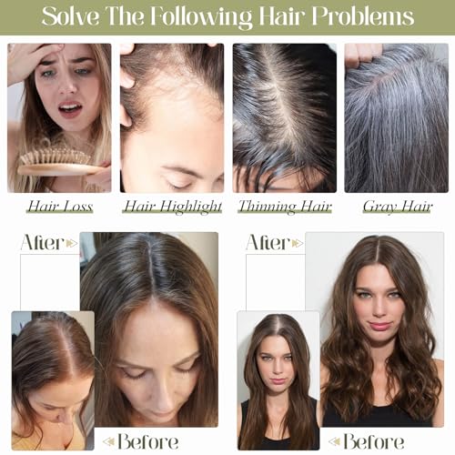 Medium Brown 10 Inch 100% Remy Human Hair Topper Q926