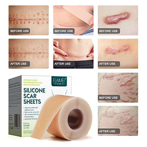 Silicone Scar Sheets Roll J530