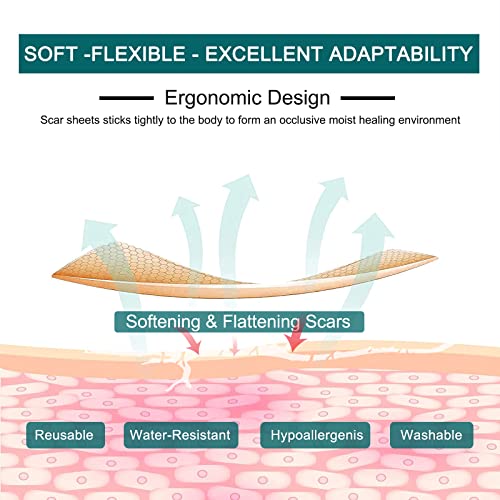 Silicone Scar Sheets Roll J530