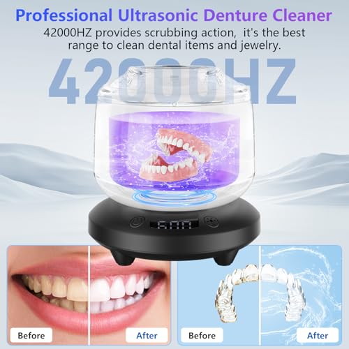 Ultrasonic Retainer Cleaner with 4 Modes (White) E809